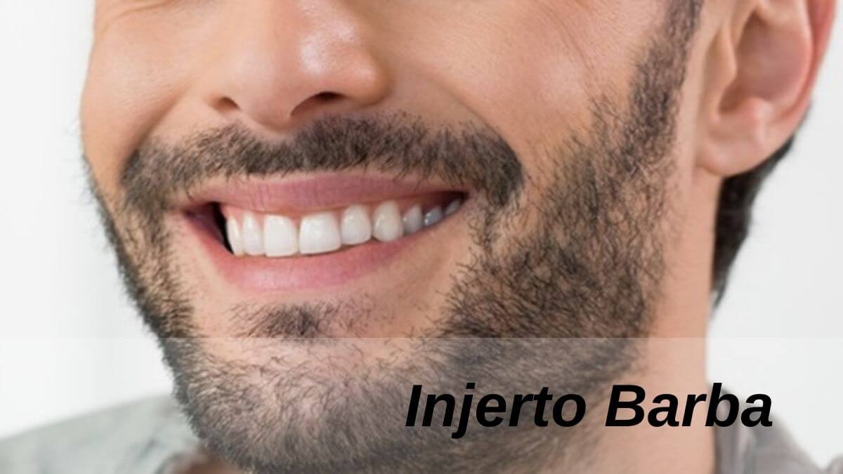 Implante De Barba