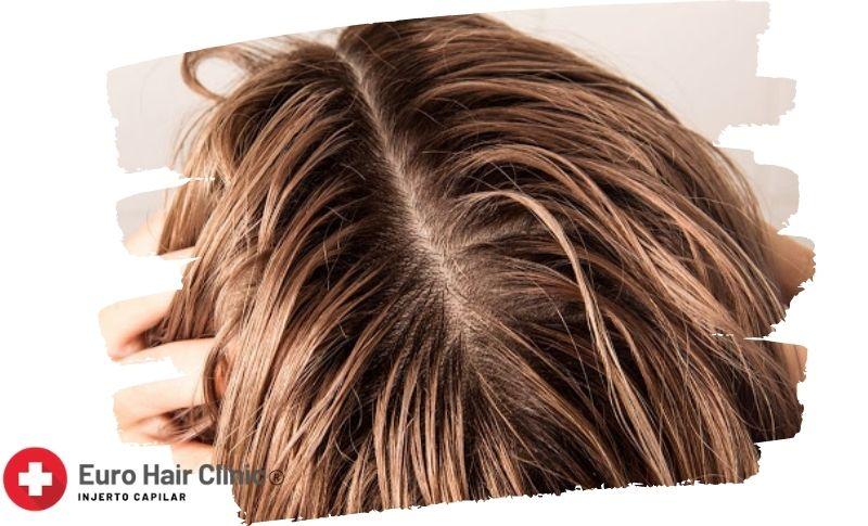 5 Trucos Para Tu Cabello - Aceitoso
