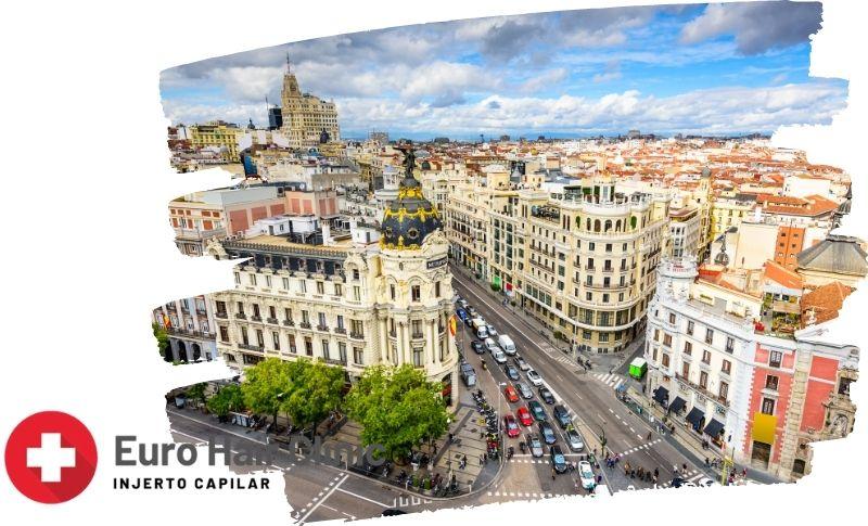 Cuanto cuesta un injerto capilar coronilla en España