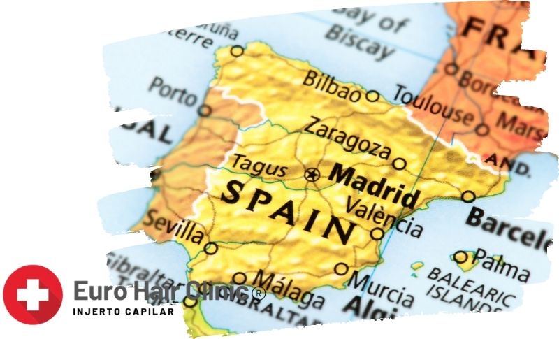 Cuanto cuesta un injerto capilar entradas en España