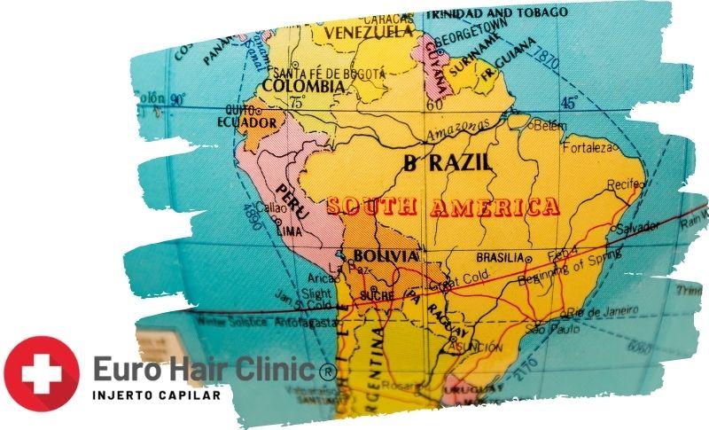 Cuanto cuesta un injerto de barba en Países latinoamericanos?