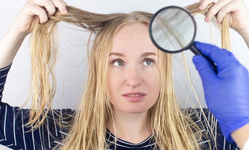 Recetas caseras para el cabello graso