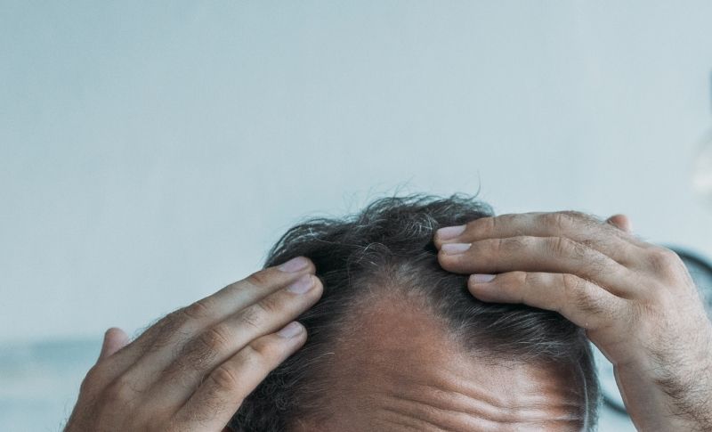 Como evitar la caída del cabello de forma natural