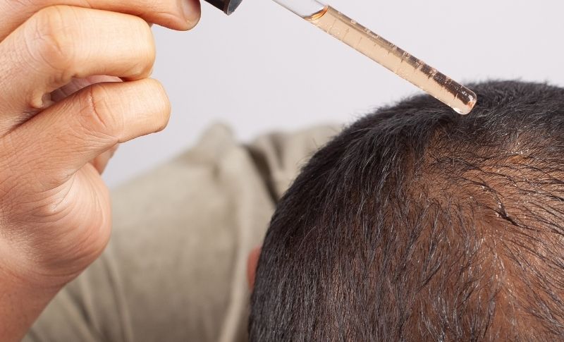 Los Vitaminas Más Importantes para el Crecimiento y Fortalecimiento del Cabello