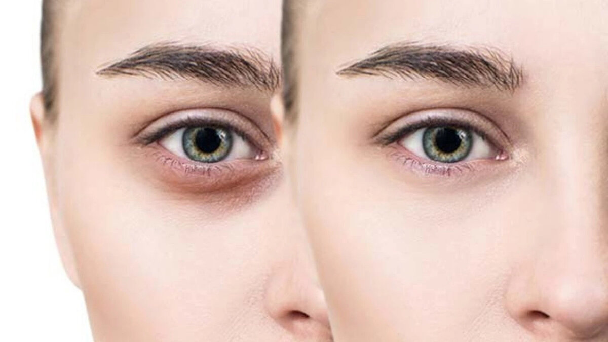 Mezcla de Agua de Rosa y Leche para las Ojeras