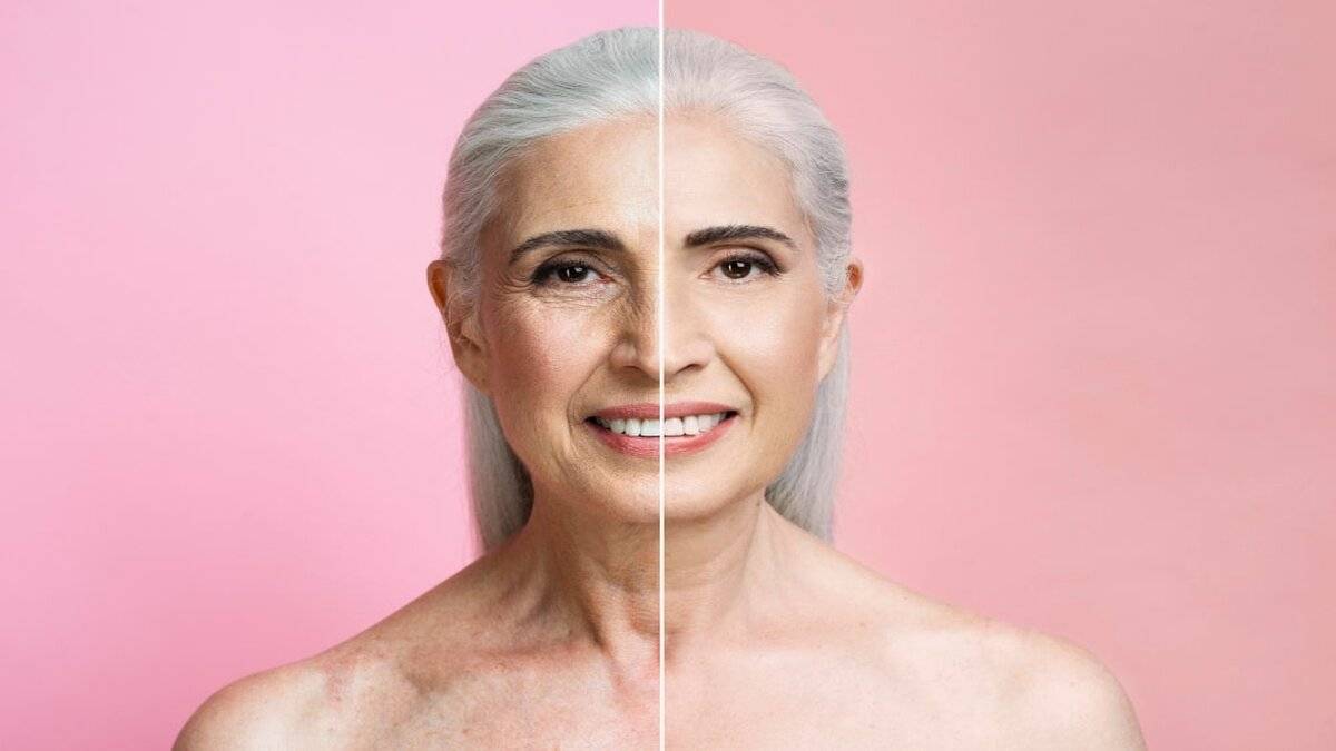 Botox: Imprescindible en Uso Estético y Médico
