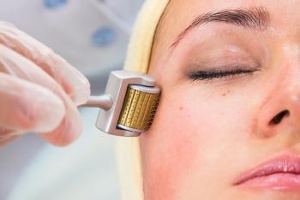 La Experiencia de Microneedling de Melia: Riesgos de las Operaciones Estéticas