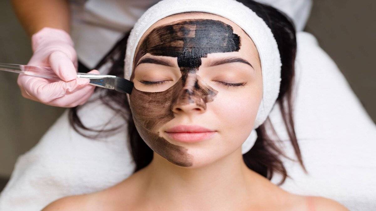 Beneficios del Peeling de Carbón